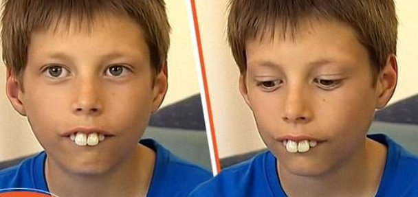 Junge, der wegen eines auffälligen Zahndefekts gemobbt wurde, bekommt dank der Freundlichkeit von Fremden ein neues Lächeln